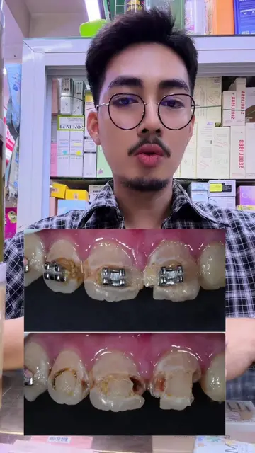 ឃើញហើយព្រឺសម្បុរណាស់…🤣🤭 #ផ្សារស្ទឹងមានជ័យថ្មី #koreanskincare #skincare #fyp #