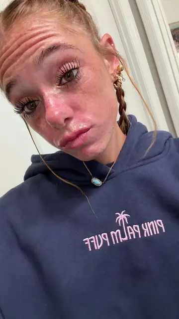 @PINK PALM PUFF #hoodie #braids #makeup #mascara #pinkpalmpuff 