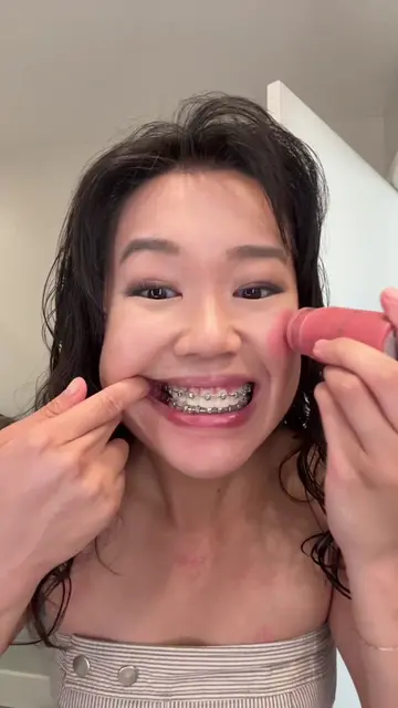 Am I crazy or unlucky or stupid #orthodontics #storytime #grwm #braces #invisali