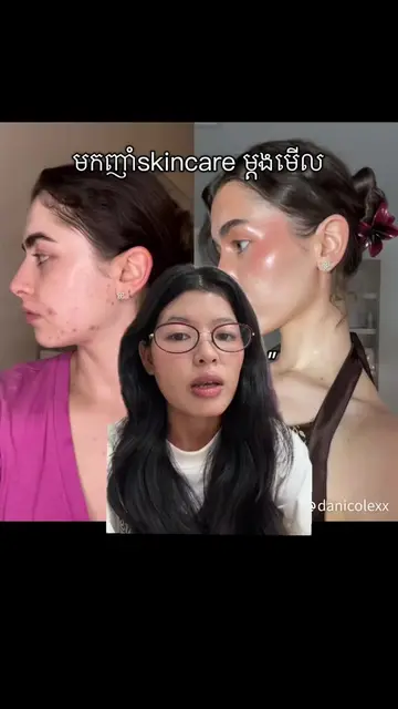 #foryou #koreanskincare #eatskincare #GlowUp