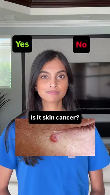 #DidYouKnow 