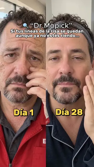 El secreto para parecer diez años más joven es este sérum 6 en 1 indicado para e