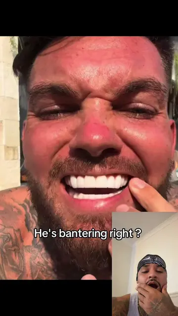 What's happening here then  #turkeyteeth #discussion #gonewrong 