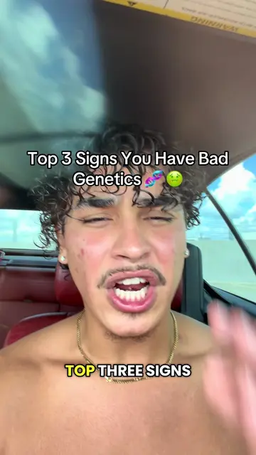 Top three signs you have bad genetics top three signs of genetic anomaly top thr