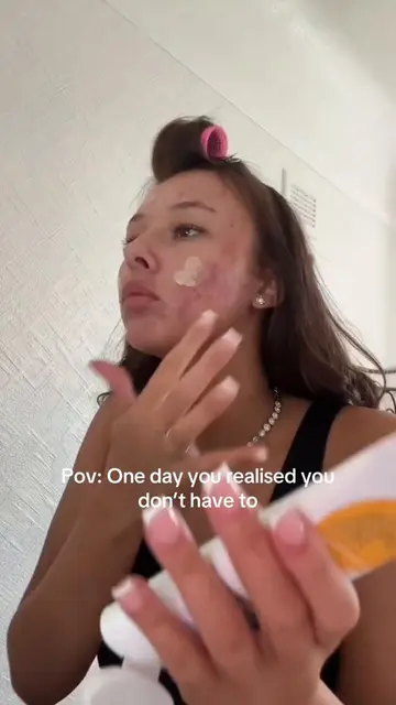 And I wouldn’t have it any other way! #acne 