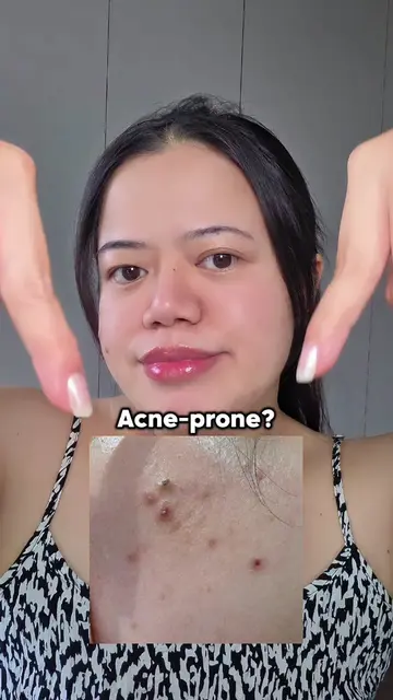 Acne-prone skin girlies… this one SAVED my skin 🥹🤍 The biodance collagen real 
