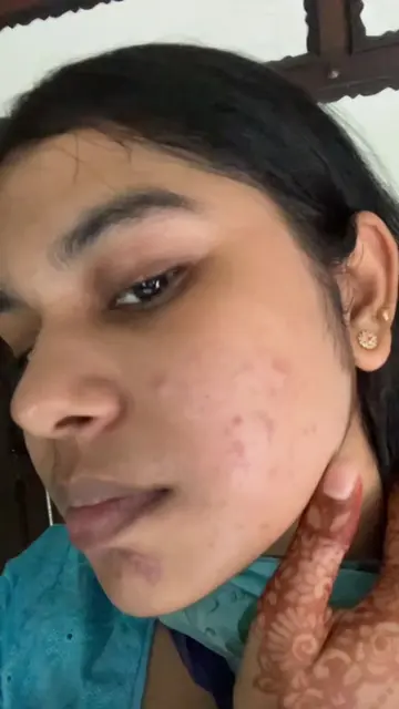 Don’t forget to say Mashallah 🥹 #fyp #goviral #transition #clearskintips #grow 