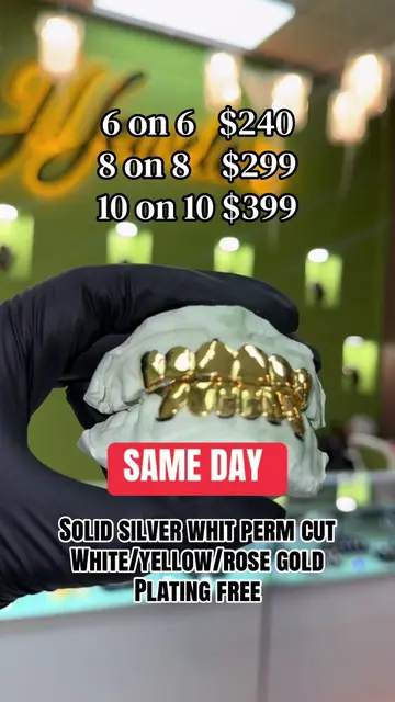 ✨ FREE DESIGNS ✨ Silver Grillz • Custom Grillz • Silver Teeth 🦷💎 FREE DESIGNS 