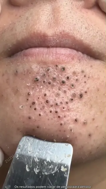 Krim Niasinamid Tea'shell hanya ₱119 — Hasil kelihatan dalam dua hari sahaja⏳ YX