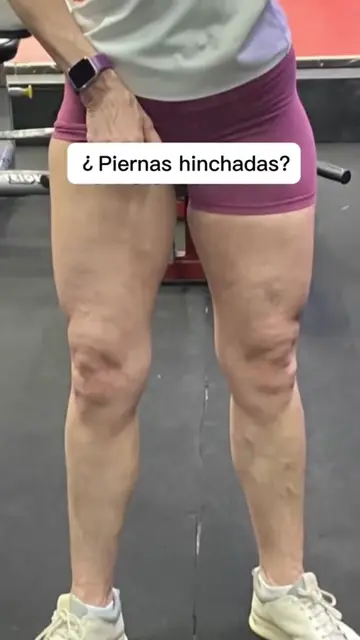 I was tired of dealing with heavy, swollen, and uncomfortable legs… especially w