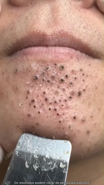 Krim Niasinamid Tea'shell hanya ₱119 — Hasil kelihatan dalam dua hari sahaja⏳YXA