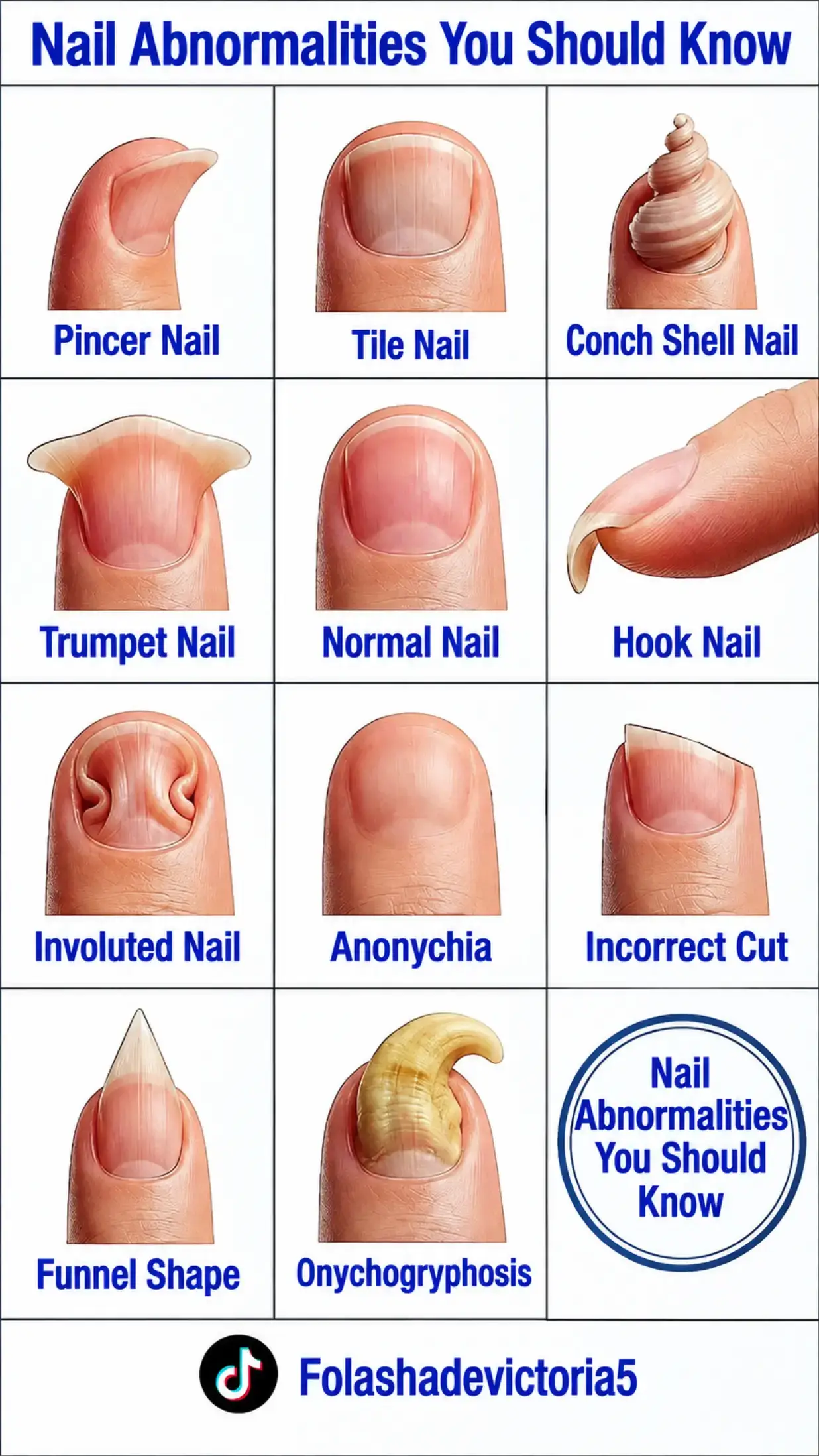 #ParentingTips #Health #HealthEducation #wellness #Nails 
