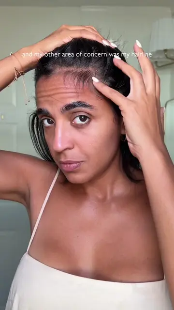 Hair shedding has been one of my biggest concerns for so long, especially on was
