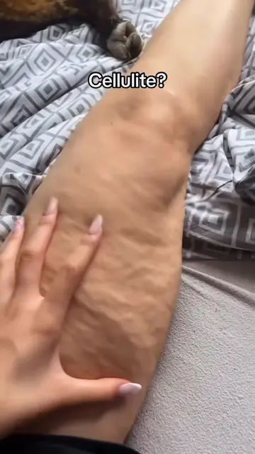 I was tired of dealing with heavy, swollen, uncomfortable legs… and I also start