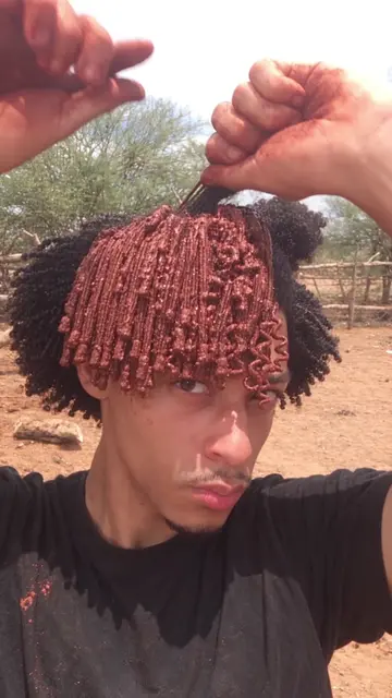 I just landed in Africa and I’m learning about traditional ways people have care