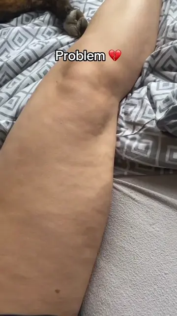 I spend 10 minutes every night reducing the look of cellulite. Same legs. Just s