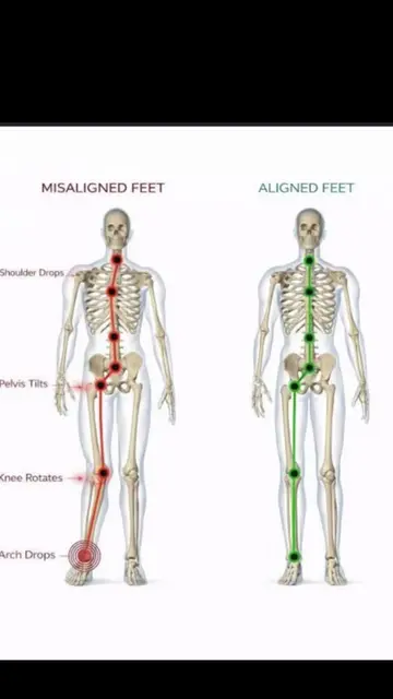#height #humanmovementscience #habits #goata #posture 
