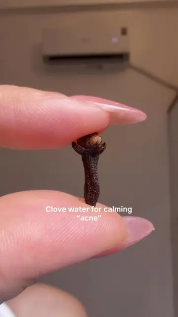 How to soothe acne with clove water #clovewater #clove #acne #acneproneskin #bea