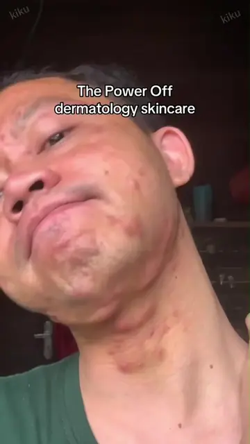 I thought it was just an ordinary moisturizer 🤩—turns out it’s incredibly effec
