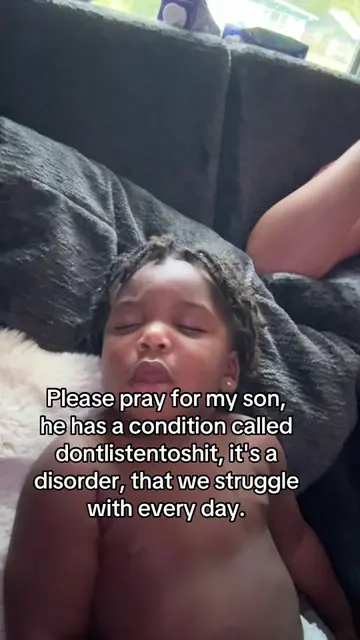 It’s so severe idk what to do #fyp #viral #baby #babies #funny 