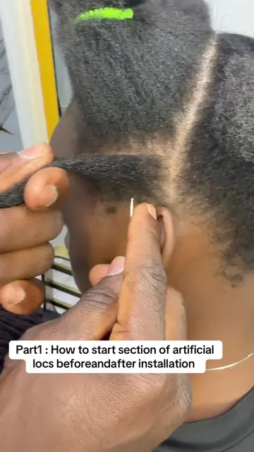Part1 : how to start section of artificial locs beforeandafter installation #par