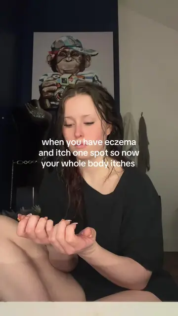 fml #eczema #relatable #repost #trendingsound #eczemaawareness  
