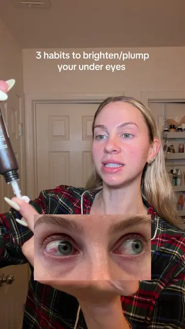 The 3 best habits for dark circles/hollow under eyes! #undereyebags #volufiline 