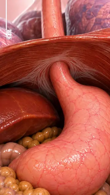 When Your Stomach Moves Into Your Chest - A hiatal hernia occurs when part of th