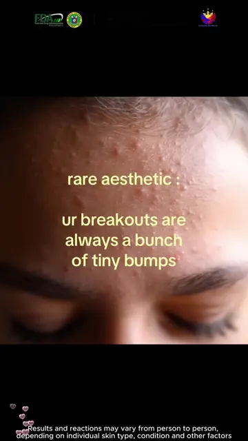 Tired of dull skin? This fixes it.YXAJH1-WRY#Darkspot #sweat #skincarehacks #fyp
