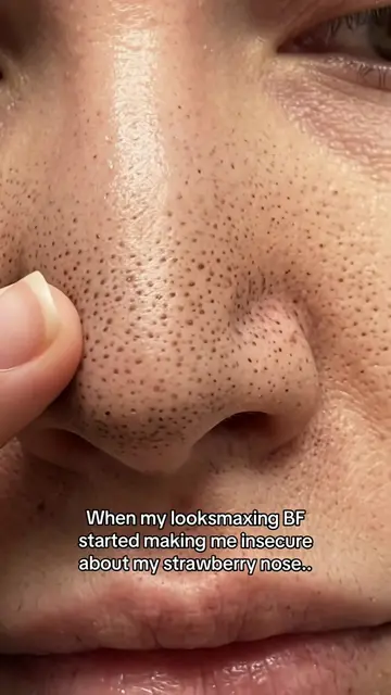 Find the pore mask at @Luelle Skin 💛💛 #porestrip #noseblackheads #cloggedpores