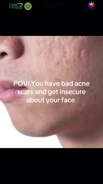 Dealing with a pitted, spotted complexion? Don’t just slather on random products