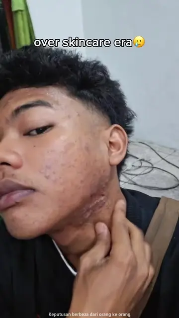 Kulit kusam & warna tidak rata? Cubalah Teashell Krim Niacinamide✨YXAMS207-hny#W