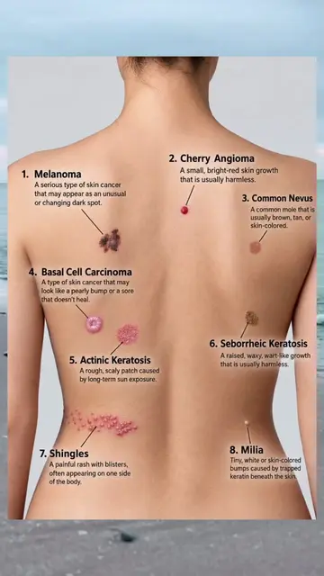 🔎 8 Skin Conditions You Should Know About! Not every skin spot is harmless. Lea