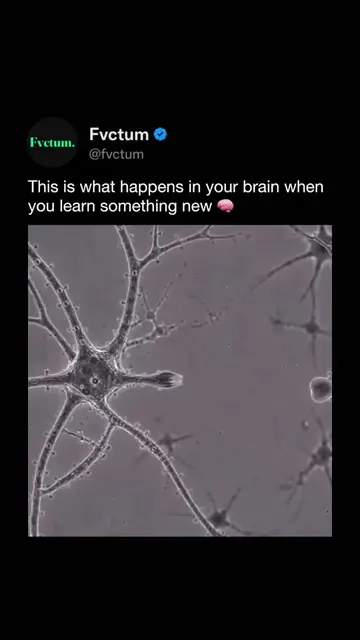 Every time you learn something new, your brain begins processing, connecting, an